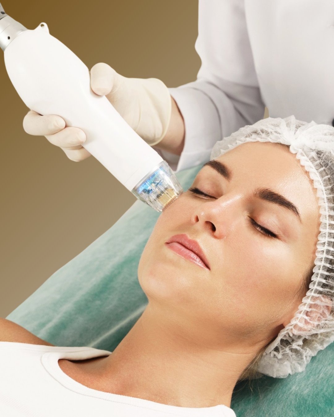 Radiofrecuencia Fraccionada