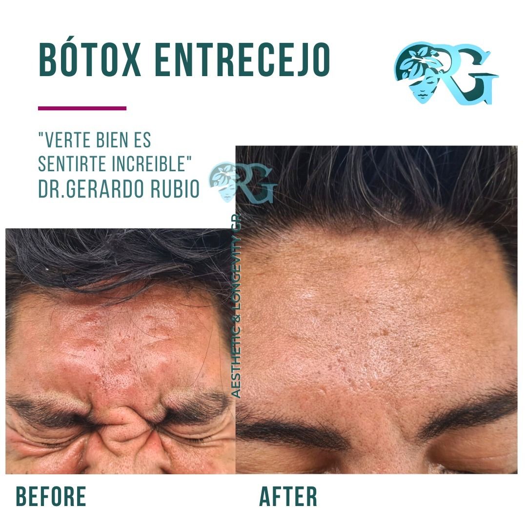 Antes-y-despues-pacientes-tratamientos
