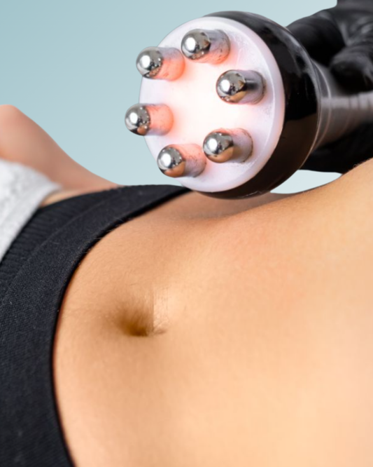 Radiofrecuencia Facial y Corporal