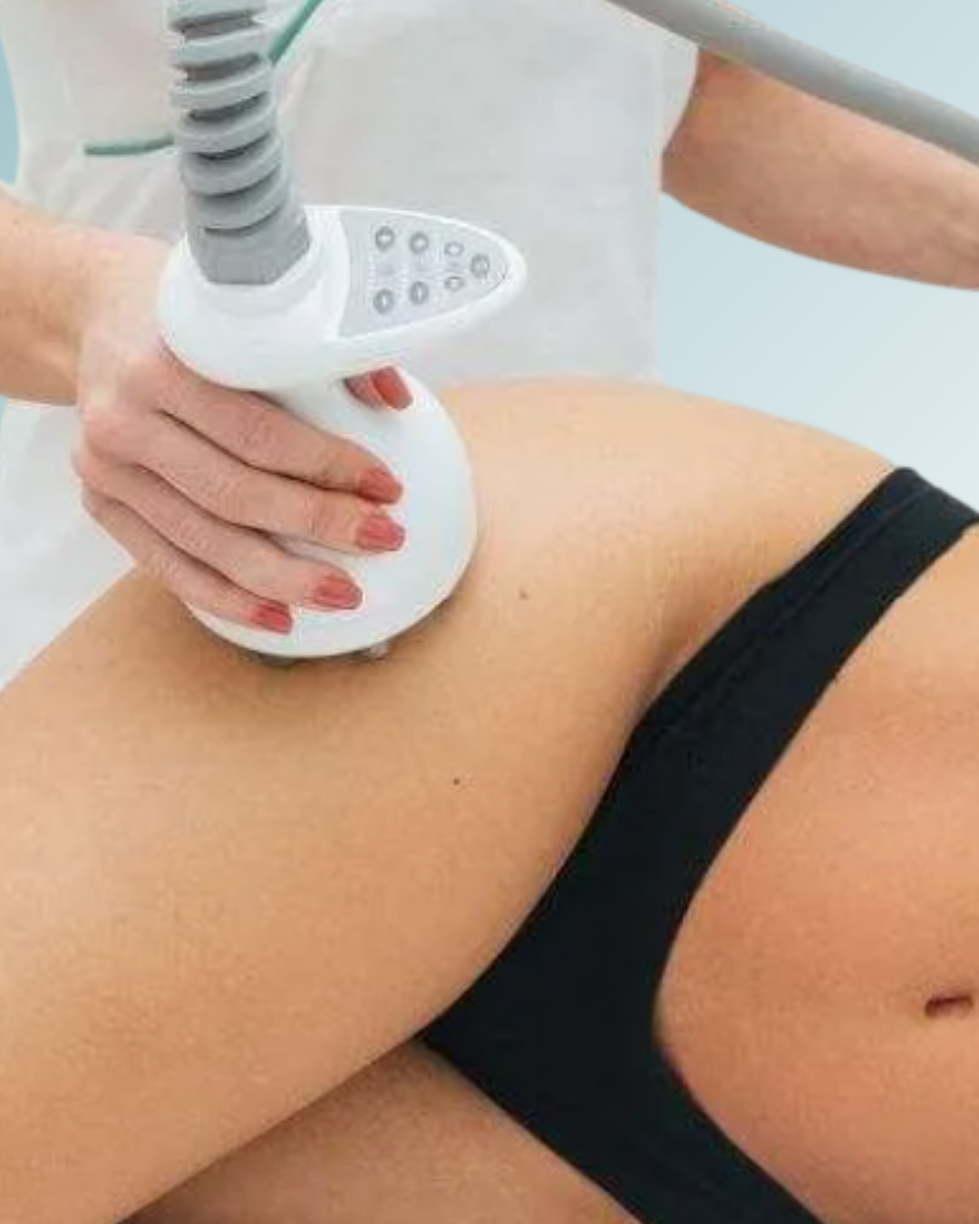 Radiofrecuencia Facial y Corporal