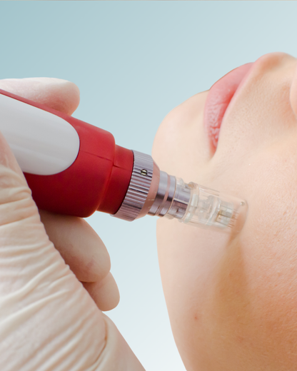 Dermapen-rostro-bello-y-bioestimuladores