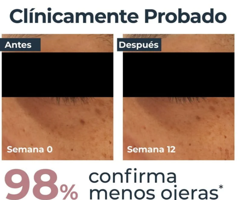 Eucerin-anti-pigment-crema-despigmentante-y-antiojeras