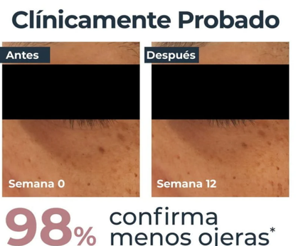 Eucerin-anti-pigment-crema-despigmentante-y-antiojeras