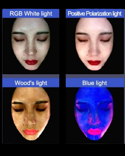 escaneo-facial-inteligencia-artificial-piel